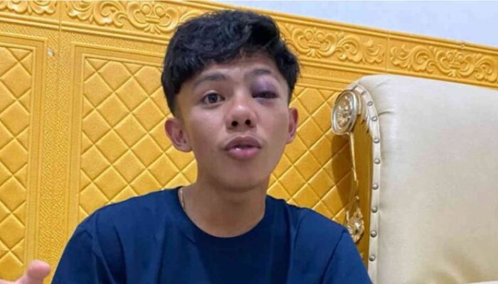 Remaja yang Dianiaya Oknum Polisi di Gorontalo Sempat Muntah Darah