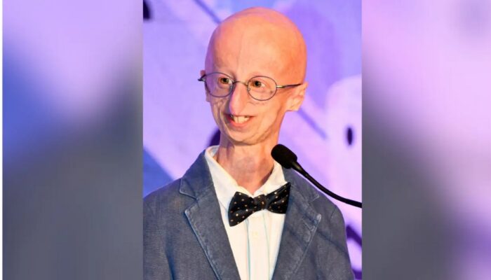 Sammy Basso, Penyintas Progeria yang Menjadi Ilmuwan Dunia