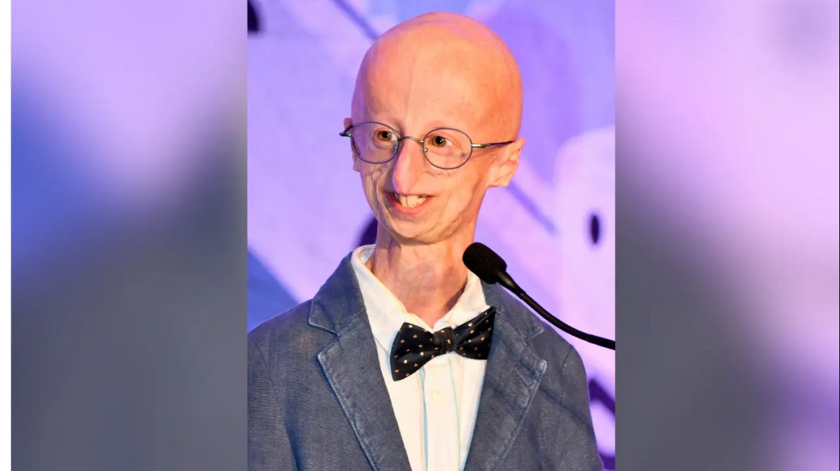 Sammy Basso menghadapi progeria hingga akhir hayatnya. Kematian pada usia 28 meninggalkan warisan inspirasi bagi banyak orang di seluruh dunia. (doc: The Progeria Research Foundation)/Hibata.id