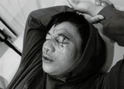 Korban Penganiayaan di Pohuwato Alami Kebutaan, Polisi Diminta Bertindak Adil